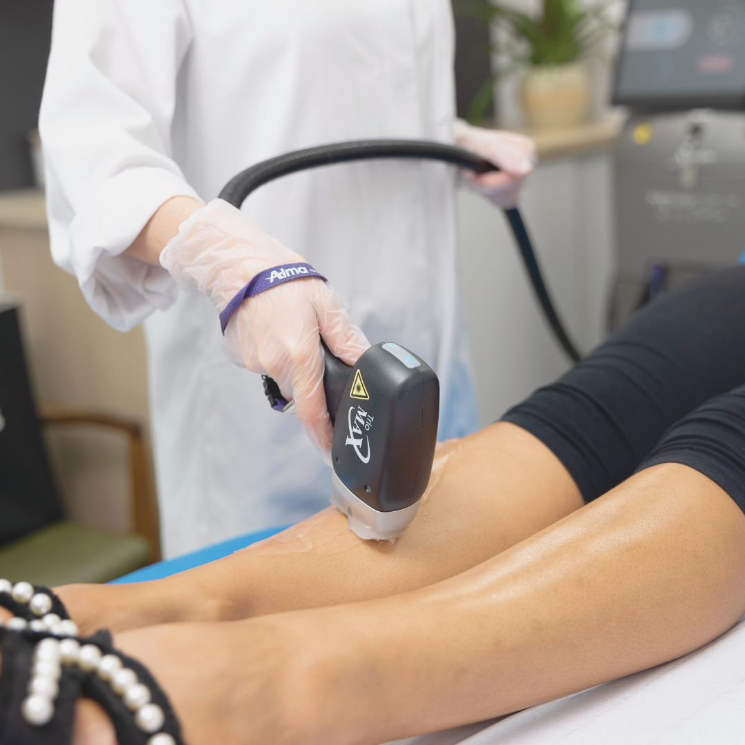 Ladies Full Body and Face Laser Hair Removal x1