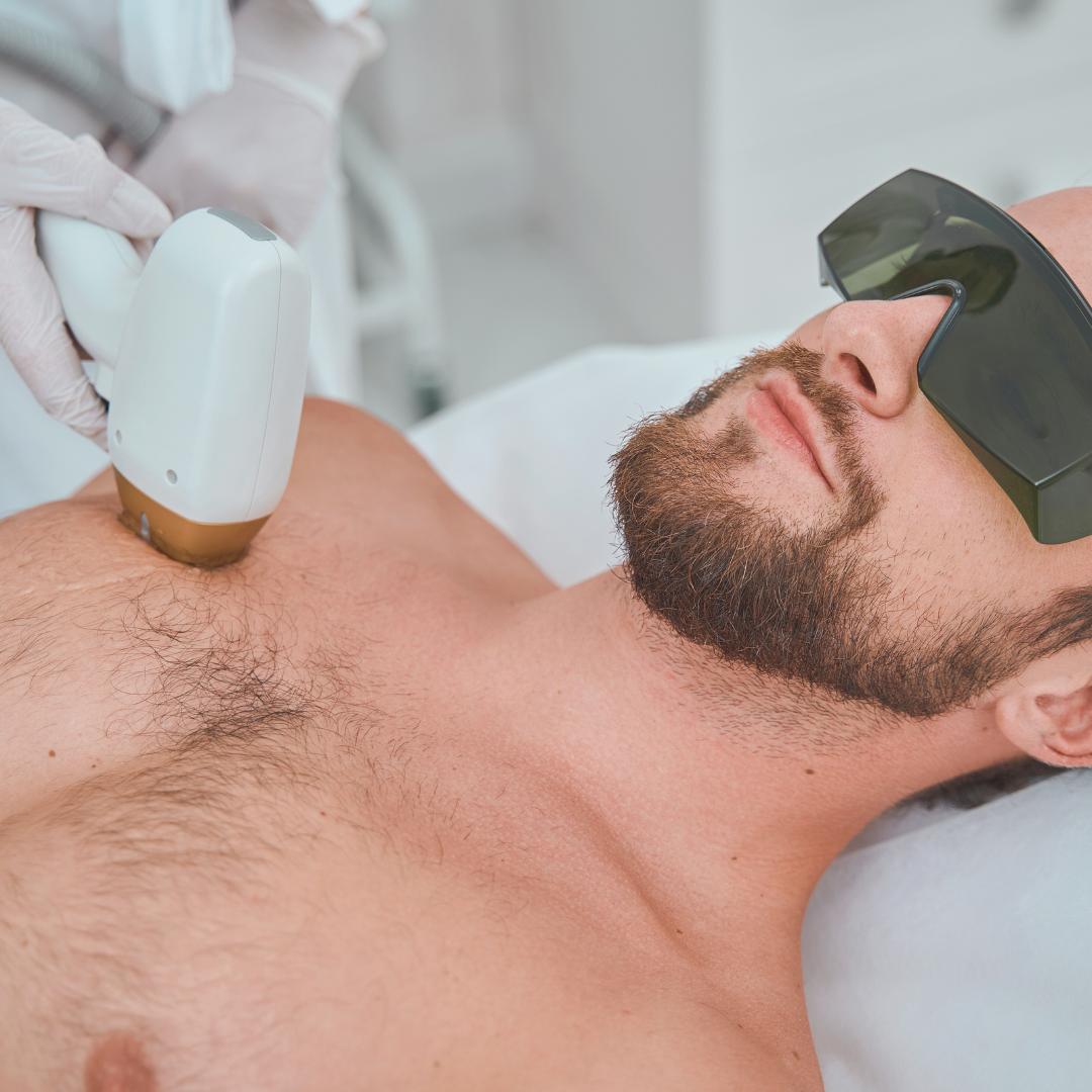 Chest and Stomach Laser Hair Removal x1