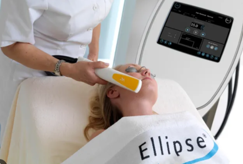 IPL Skin Rejuvenation x5