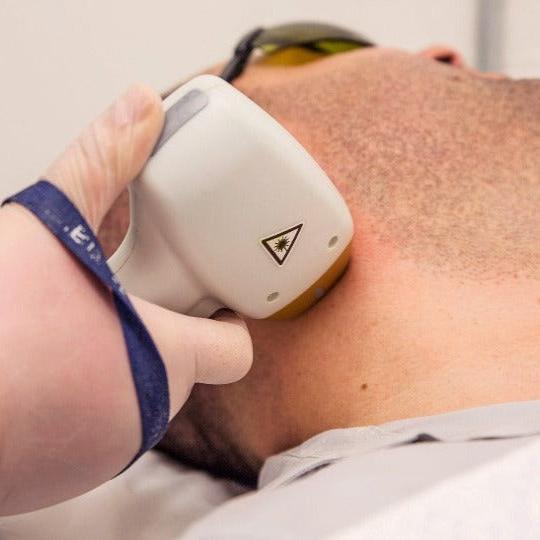 Beard Laser Hair Removal x8