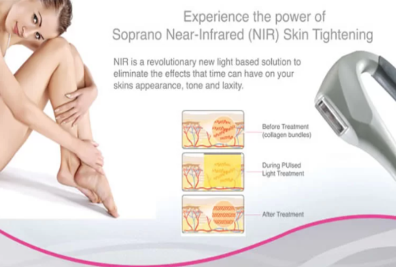 Nir Skin Tightening Facial - Face x1