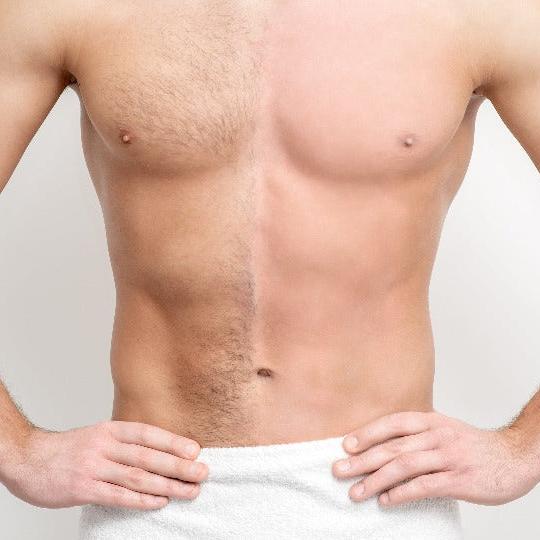 Men's Full Body and Face Laser Hair Removal x1