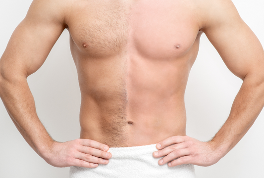 Men's Full Body laser Hair Removal x1