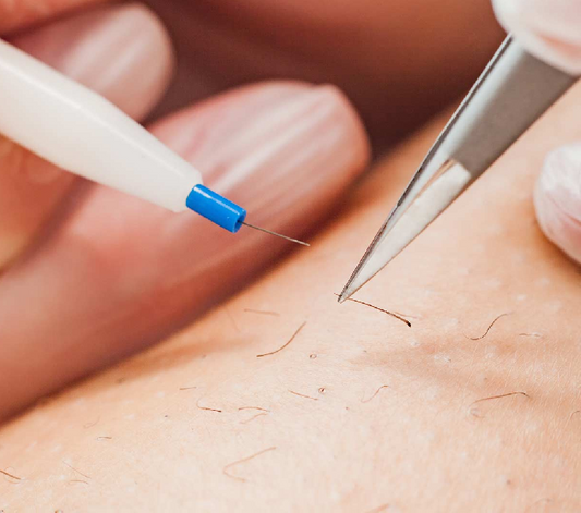 Electrolysis 10 hour course