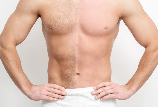 Men's Full Body and Face Laser Hair Removal x1